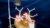 sprynpa1